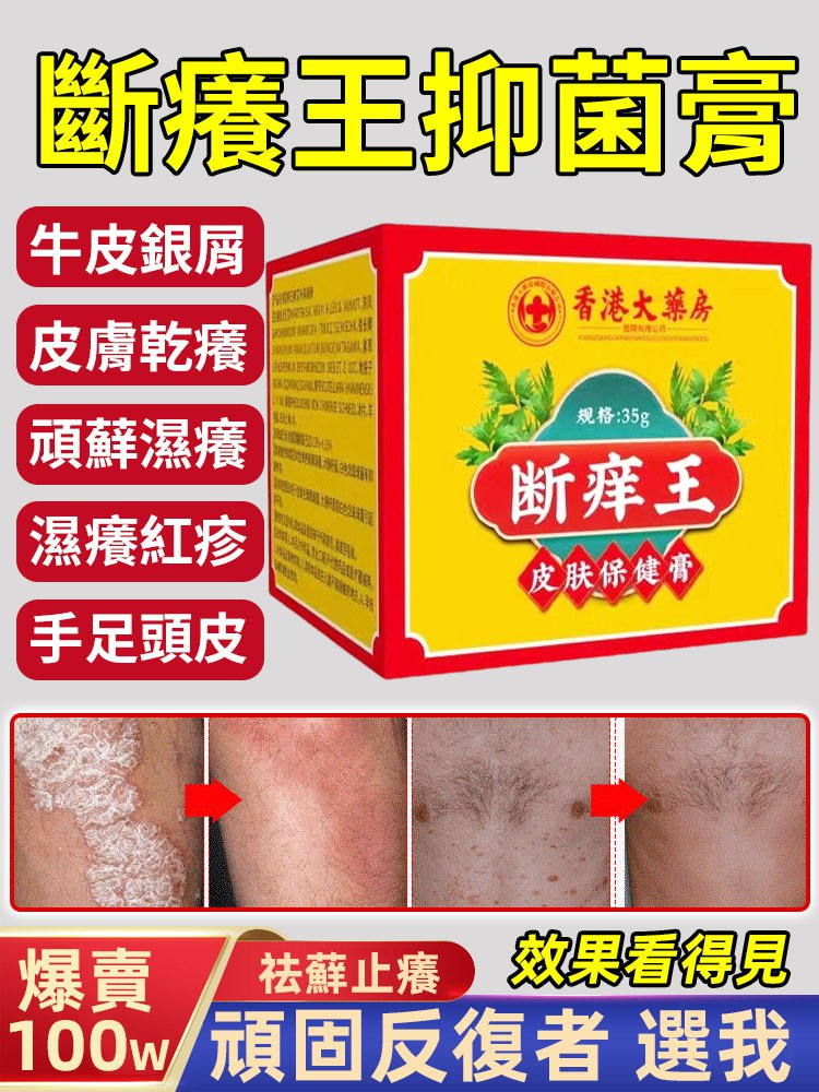 斷癢王抑菌膏,正品斷癢王抑菌膏,家中常備,大人小孩都能用,草本植物配方,溫和滋潤,止癢抑菌 斷癢王抑菌膏,正品斷癢王抑菌膏,家中常備,大人小孩都能用,草本植物配方,溫和滋潤,止癢抑菌